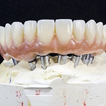 model of All-on-4 implants