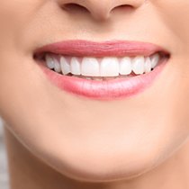 cosmetic bonding procedure