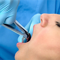 Closeup of patient during tooth extraction