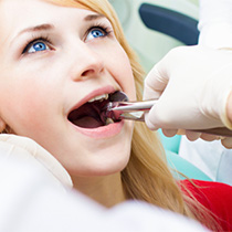 Young woman having tooth extracted