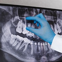 Astoria emergency dentist looking at X-ray