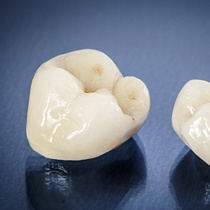 dental crowns