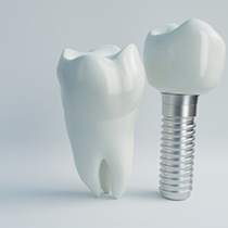 dental implant with crown next to natural tooth 