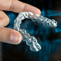 Invisalign aligner