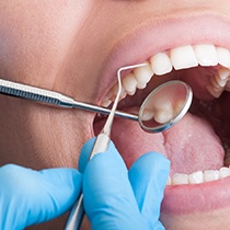 dentist looking inside patient’s mouth