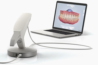 Digital dental impressions machine