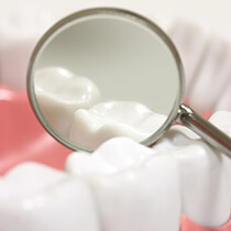 dental mirror lying on model teeth