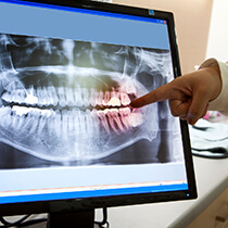 Dentist pointing at x-ray