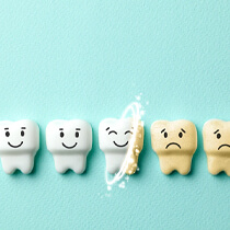 Illustration of teeth whitening