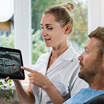 A dentist showing an impacted wisdom tooth to her patient