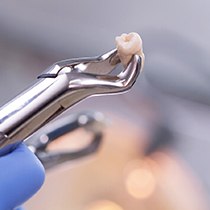 Dental forceps holding an extracted wisdom tooth