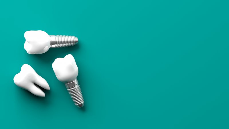 Dental implants